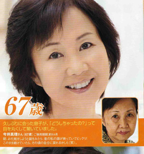 67歳　びっくりNO1